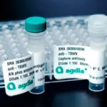 Reagent Set for American plum line pattern virus (APLPV) - Plant ELISA Antibody Set - Immunomart