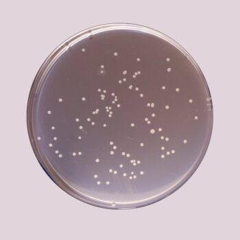 Plate Count Agar (Standard Methods Agar)