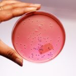 HiMedia GM317 - distributed by Immunomart