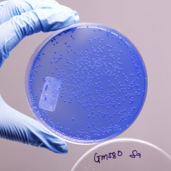 HiMedia GM580 - distributed by Immunomart