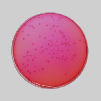 Xylose Lysine Deoxycholate Agar (XLD