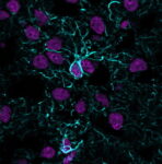 BNC041974-GFAP-ASTRO-1974R-BNC470957-Histone-H1-HH1-957