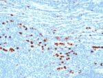 Calgranulin B / MRP-8/-14 / MAC 387 / S100A8/A9 / Macrophage Ag(MAC387), Biotin conjugate, 0.1mg/mL