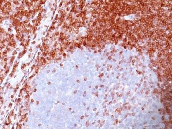 bcl-2(100/D5), CF488A conjugate, 0.1mg/mL