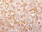 ACTH (Adrenocorticotrophic Hormone)(57), CF594 conjugate, 0.1mg/mL