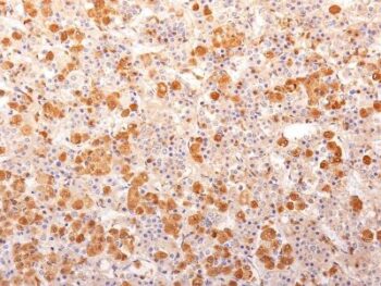 ACTH (Adrenocorticotrophic Hormone)(57), CF594 conjugate, 0.1mg/mL