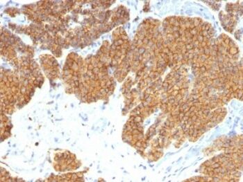 PTH / Parathyroid Hormone (N-Terminal)(3H9), CF640R conjugate, 0.1mg/mL