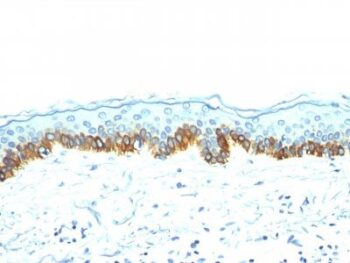 Cytokeratin, LMW(AE-1), 0.2mg/mL