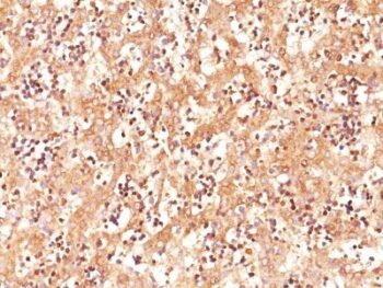 AFP (Alpha Fetoprotein)(C3), 0.2mg/mL