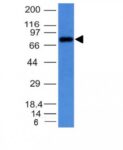 Human IgM Immunoglobulin(IM373), CF640R conjugate, 0.1mg/mL