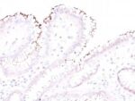 Helicobacter pylori(Rabbit PAb), CF594 conjugate, 0.1mg/mL