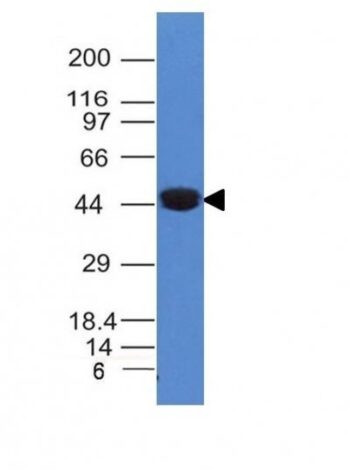 Cytokeratin 8(K8/383), 1mg/mL