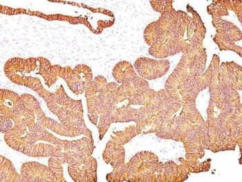 Ep-CAM / CD326(323/A3), 0.2mg/mL