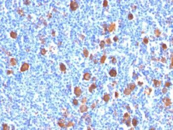 Fascin-1(FSCN1/416), Biotin conjugate, 0.1mg/mL