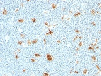 Calprotectin (MRP14)(S100A9)(CAGB/426), 0.2mg/mL
