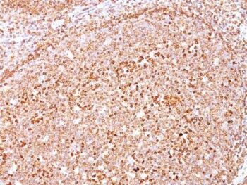 CD79a(HM47/A9), 0.2mg/mL