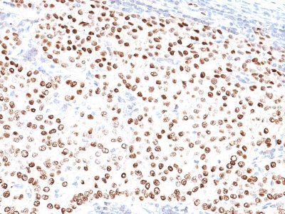 BNUB0500-0-1 BNUB0500 0 1- Immunomart