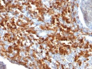 CD79a(IGA/515), 0.2mg/mL