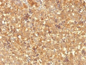 AFP (Alpha Fetoprotein)(MBS-12), CF647 conjugate, 0.1mg/mL