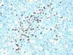 Human Lambda Light Chain(LcN-2), 1mg/mL