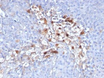 CD146 / MCAM / MUC18 / Mucin 18(C146/634), 1mg/mL