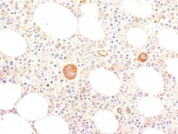 von Willebrand Factor(VWF635), CF740 conjugate, 0.1mg/mL