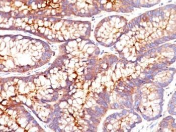 CD66 (CEA)(CEA31), CF594 conjugate, 0.1mg/mL