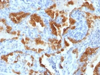 Cytokeratin 8(H1 + TS1), 0.2mg/mL