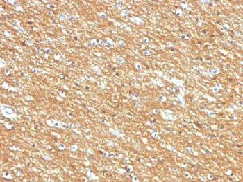 CD56 / NCAM(123A8, same as 56C04), CF594 conjugate, 0.1mg/mL