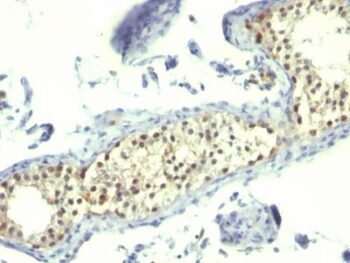 Thymidylate Synthase(TS106), CF640R conjugate, 0.1mg/mL