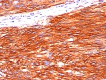 VEGFR2 / Flk-1 / KDR3 / CD309(KDR721), CF740 conjugate, 0.1mg/mL
