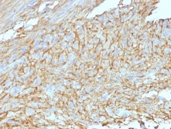 DOG-1(DG1/447 + DOG1.1), CF640R conjugate, 0.1mg/mL