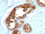 TAG-72 / CA72.4(B72.3 + CA72/733), 0.2mg/mL