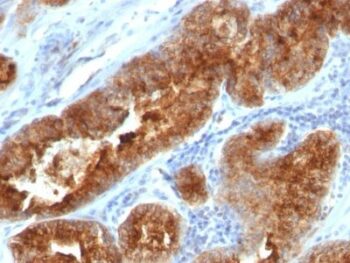 TAG-72 / CA72.4(B72.3 + CC49), CF568 conjugate, 0.1mg/mL
