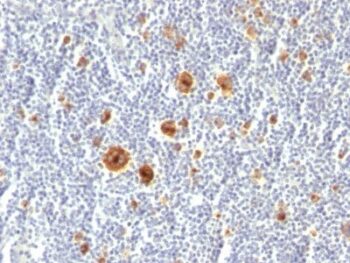 CD30(Ki-1/779), 0.2mg/mL