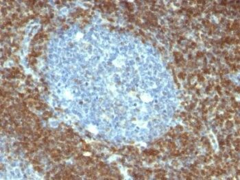 bcl-2(BCL2/796), 0.2mg/mL