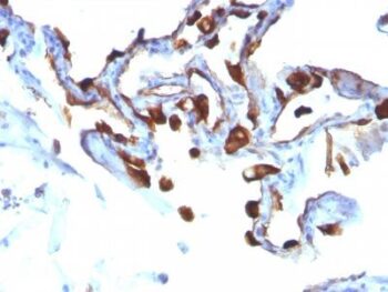 Cytokeratin 8(KRT8/803), 0.2mg/mL