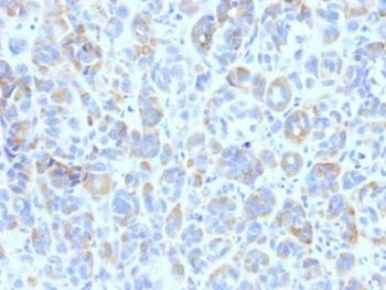 TRP1 (Tyrosinase Related Protein 1)(TYRP1/807), 0.2mg/mL