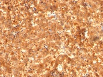 AFP (Alpha Fetoprotein)(C2 + C3 + MBS-12), 0.2mg/mL