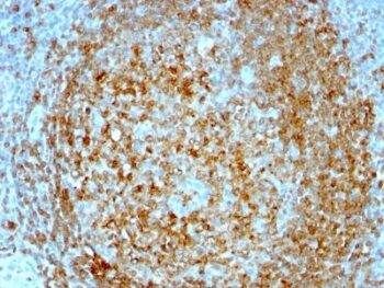 CD74(CLIP/813), 0.2mg/mL