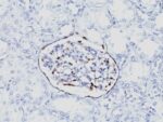 WT1 (Wilm's Tumor 1)(6F-H2), CF594 conjugate, 0.1mg/mL