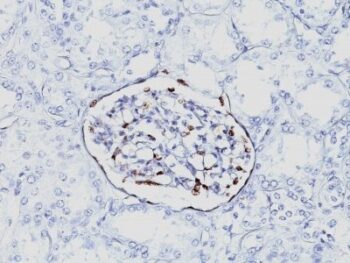 WT1 (Wilm's Tumor 1)(6F-H2), CF594 conjugate, 0.1mg/mL