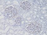 WT1 (Wilm's Tumor 1)(WT1/857), CF640R conjugate, 0.1mg/mL