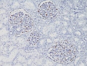 WT1 (Wilm's Tumor 1)(WT1/857), CF640R conjugate, 0.1mg/mL