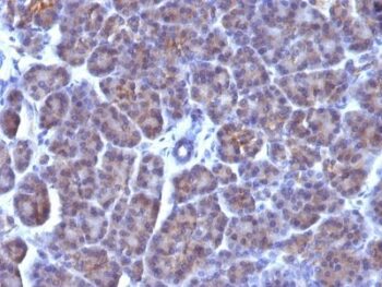 Nuclear Membrane(AE-5), CF568 conjugate, 0.1mg/mL