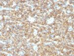 CD99(HO36-1.1), 1mg/mL 1 BNUB0869-0-1