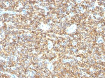 CD99(HO36-1.1), 0.2mg/mL