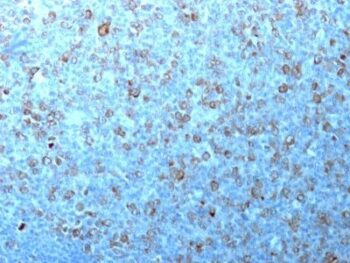 p34 / cdk1(CDK1/873), CF640R conjugate, 0.1mg/mL