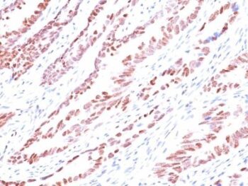 p57 / KIP2(KP10), CF594 conjugate, 0.1mg/mL