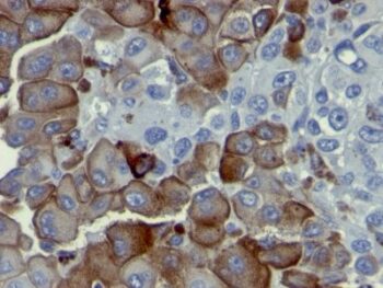 NGFR (Nerve Growth Factor Receptor)(NGFR5), CF740 conjugate, 0.1mg/mL